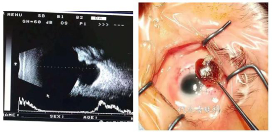 【大爱同医仁】泰安同医仁眼科医院代永青：不忘医者初心，以责任践行医者使命